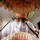 Nanos : un plombage qui tue les bactéries et reminéralise la dent