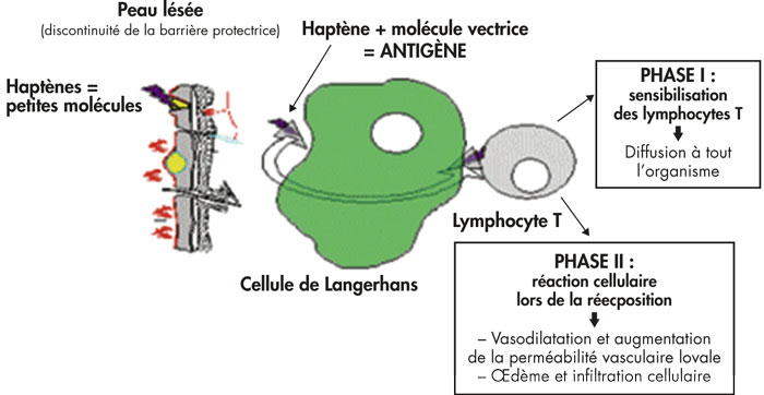 Schéma simplifié de l’allergie de type IV