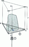 Figure 81 - Example of a helical connection: trifilar system