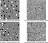 Figure 7 - Thresholding procedure for simulations I and II