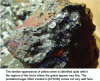 Figure 10 - Goethite, and its various appearances, from shiny, metallic pale grey to powdery dull yellow