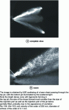 Figure 10 - Image of a multi-hole injector (4 holes) (full view on the left and zoom on the right) in atomization mode [74].