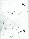 Figure 15 - Electron microscope photograph of gold colloid aggregates in a case of slow aggregation [photograph: D. Weitz].