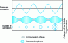 Figure 8 - Cavitation bubble growth and implosion