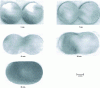 Figure 12 - Morphological evolution of two glass cylinders (r = 1.5 mm) during sintering at 950°C [10]