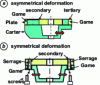 Figure 26 - Compensating for center distance differences