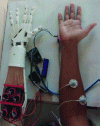 Figure 9 - Hand prosthesis developed in a fab lab (credit: Fab lab Dhaka University)
