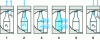 Figure 14 - Hydrogenated carbon plasma deposition process (Sidel)