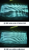 Figure 14 - SMC surface irregularities caused by undulations in the molded part (mold coverage 40%)