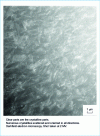 Figure 2 - Aspect of polyetheretherketone (PEEK) crystallinity by darkfield electron microscopy. Heat treatment of PEEK: Tm = 360 °C, Tc = 310 °C