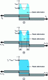 Figure 30 - Stress concentration profile of a bonded joint subjected to tensile-shear stress