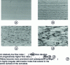 Figure 6 - Progressive development of surface deformations for LLDPE at increasing flow rates (courtesy of L. Kale)