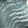 Figure 7 - Undulating defect obtained in the extrusion of polypropylene flat film: volume deformations. The droplets are linked to the polymer additives rather than to the extrusion defect.