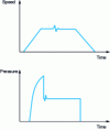 Figure 18 - Examples of irregularities in the speed and pressure curves