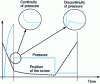 Figure 6 - Continuity and discontinuity of pressure during switching