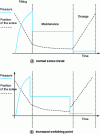 Figure 11 - Switching point increase