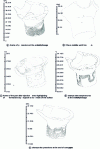 Figure 28 - Example of numerical simulation results (doc. Simpoe France)