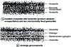 Figure 25 - Geotextile drainage