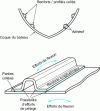 Figure 4 - Bonding reinforcing sections to a hull or box: various (peeling) forces at the bonding point