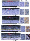 Figure 17 - Microscopic observations of carbon/glass/PEEK
laminates subjected to a kerosene flame for different durations