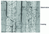 Figure 21 - Compression damage (x 300)