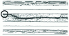 Figure 9 - Free edge priming, interface - 45/90 composite [0/+ 45/- 45/90]S