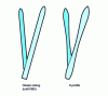 Figure 8 - Wasp-waisted ski shape