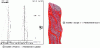 Figure 22 - Finite element" calculation models for estimating stress levels leading to local and global buckling