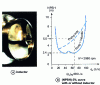 Figure 18 - Use of an inductor: (NPSH) curves – 3%(doc. GEC-Alsthom Bergeron)