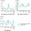 Figure 26 - Variations in minimum thickness, friction torque and axial flow as a function of crankshaft angle (Citroën 2N engine)