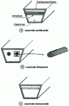 Figure 6 - Wrapped belts