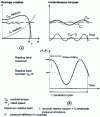 Figure 20 - Shaft line behavior at nominal operating speed