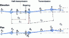 Figure 25 - Semi-transmission and transmission assemblies