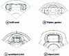 Figure 24 - Recent developments based on the tripod joint: AAR Triplan and quadripod