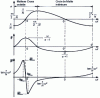 Figure 52 - Displacement, speed and acceleration diagrams for both types of Maltese Cross mechanism