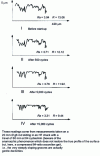 Figure 8 - Reality and conventional roughness measurement (figures  and )