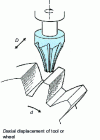 Figure 2 - End milling