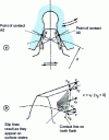 Figure 26 - Direction and orientation of various meshing slips