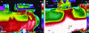 Figure 23 - IR camera views of the heat exchanger shell, left: wide view showing 3 by-passes, right: zoomed-in view of the main by-pass at the level of the fluid supply manifolds on the shell side (NeoTherm Consulting SAS).