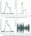 Figure 14 - Inversion of simulated measurements with the analytical model