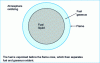 Figure 4 - Combustion of a drop of fuel in an oxidizing atmosphere