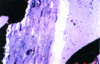 Figure 4 - Example of observation of different groups of macerals on a coal particle