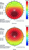 Figure 4 - Sun disk for the city of Lyon and Gillot (Reunion Island) (doc. CEA INES)