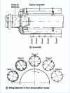 Figure 15 - Balloon distribution on the discharge ferrule