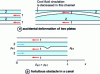 Figure 14 - Incidents between two plates or in a tube