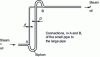 Figure 12 - Double ascending pipe