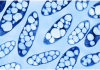 Figure 26 - Bacteria filled with PHA granules (doc. Plastix.it)