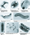 Figure 2 - Transmission electron microscopy of magnetotactic bacteria and their magnetosomes