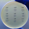 Figure 1 - Discovery of a phage by observing the appearance of a lysis zone in a microbial mat.