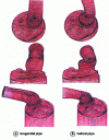 Figure 13 - The two pipe concepts